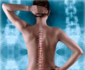 illustration de la colonne vertébrale arrière