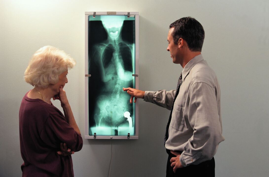 diagnostic radiologique pour la douleur dans l'articulation de la hanche